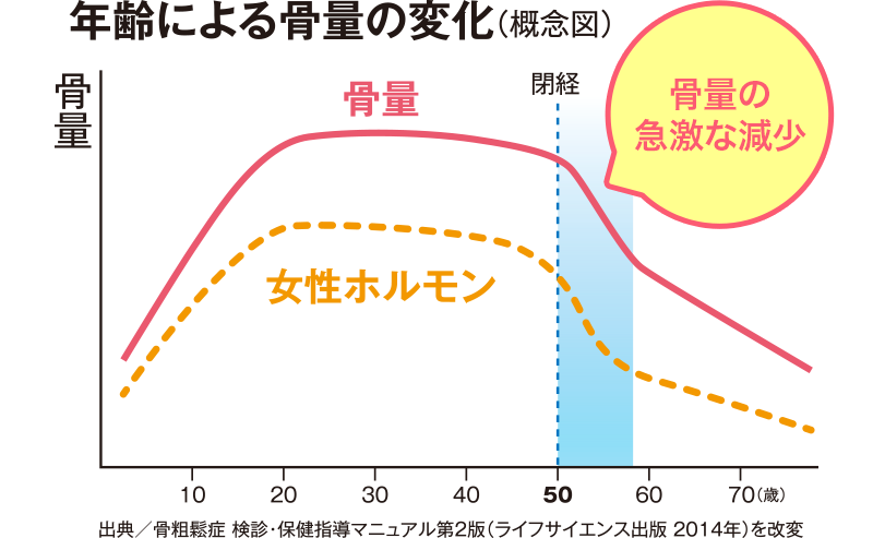 年齢による骨量の変化（概念図）